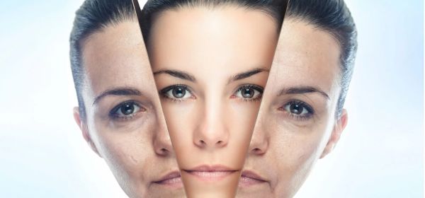 Chemical Peels