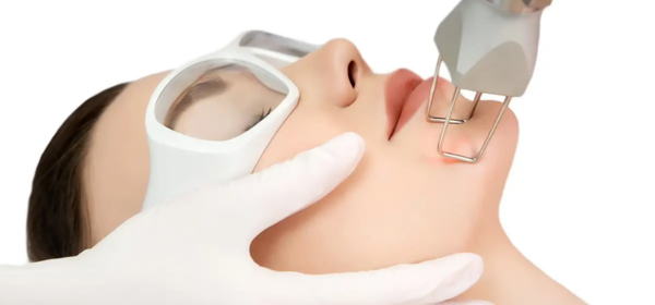 Fractional CO2 Laser