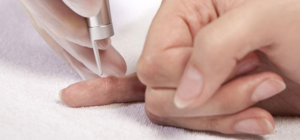 Laser Therapy