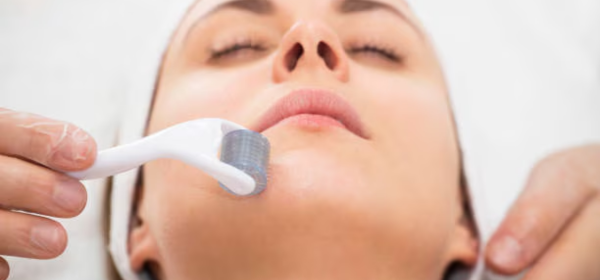 Microneedling with Brightening Serums