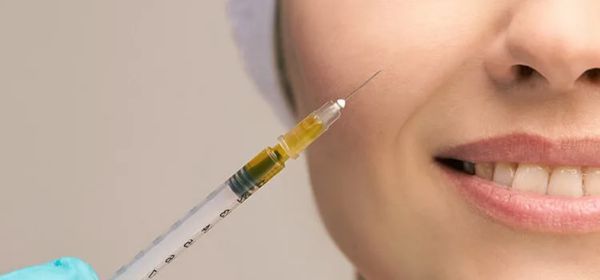 Microneedling with PRP