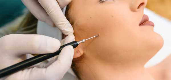 Shave Excision