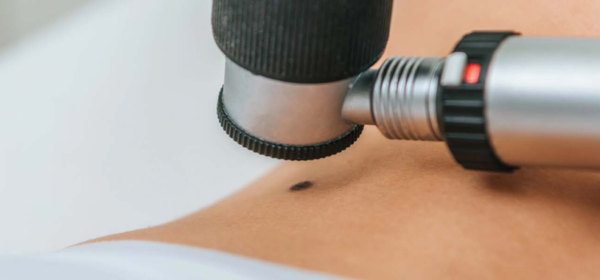 Surgical Excision