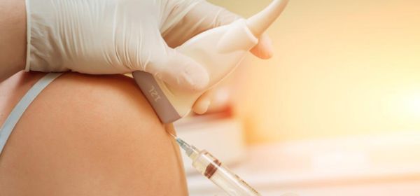 PRP Procedure