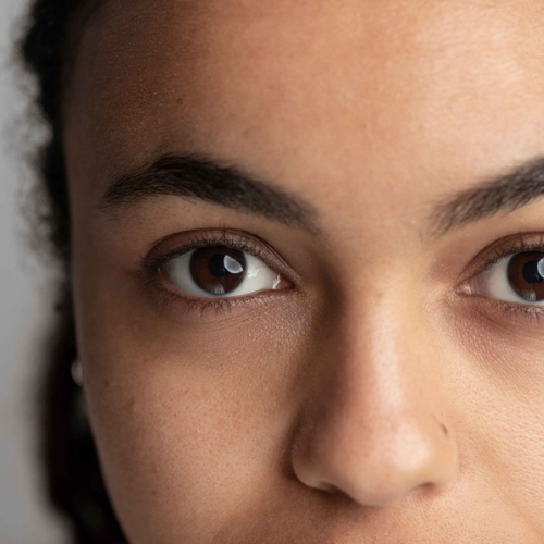 Dark Circles Removal