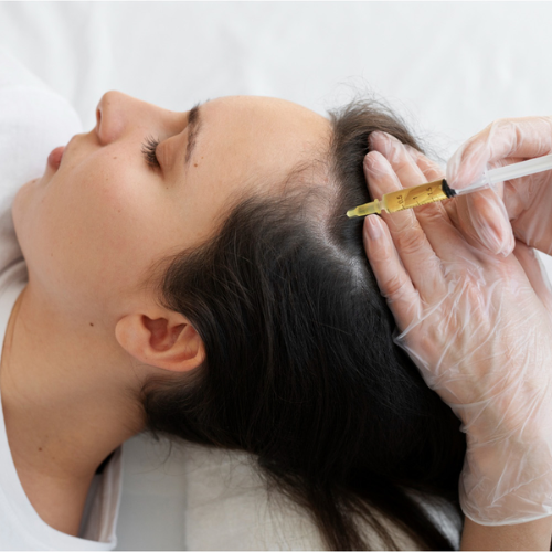 PRP Treatment