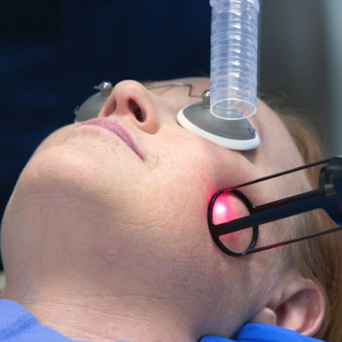 Fractional CO2 Treatment Process