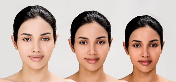 Before Treatment