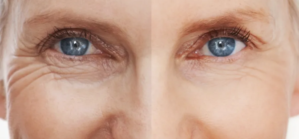 Before Treatment