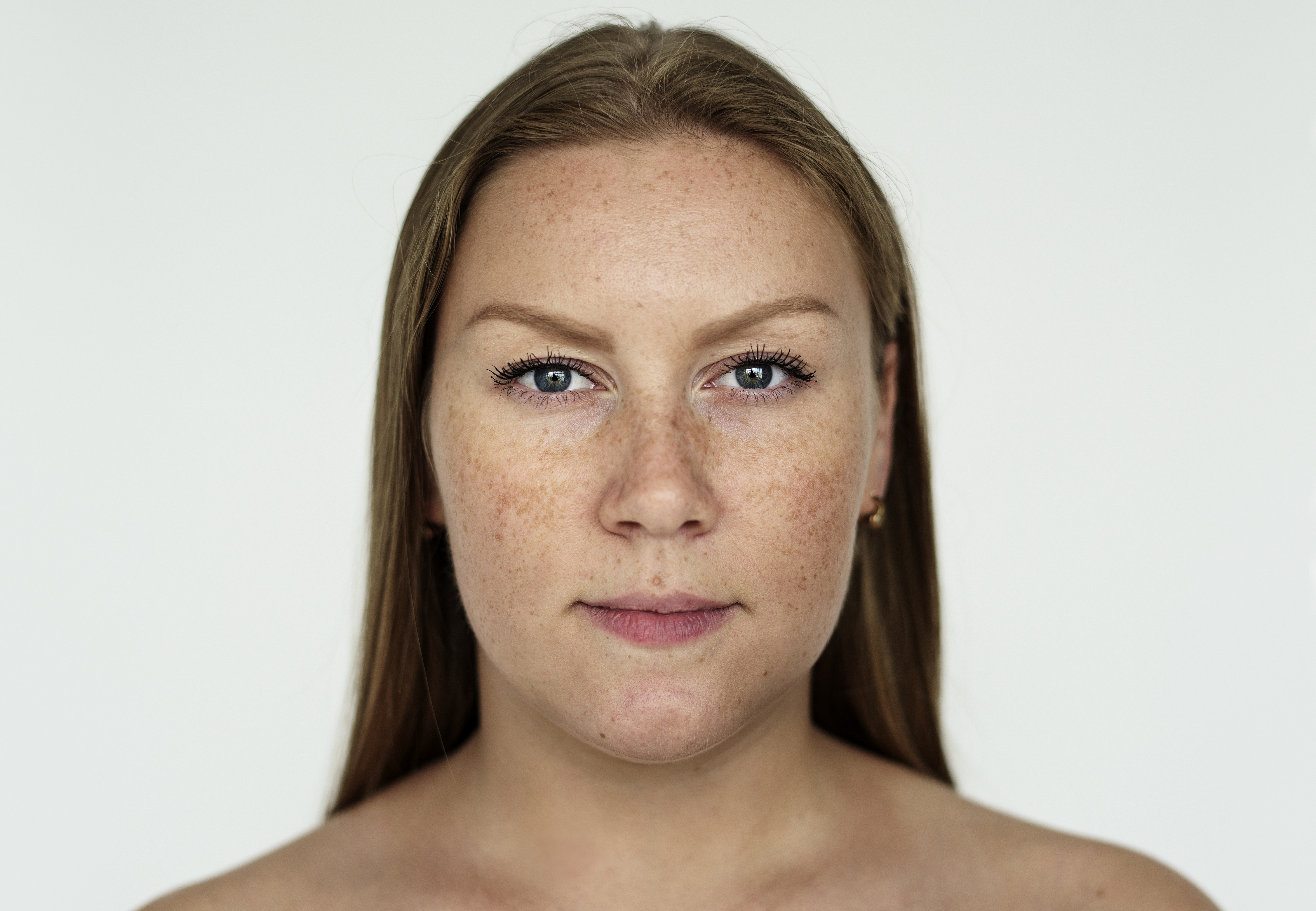 Pigmentation Treatment