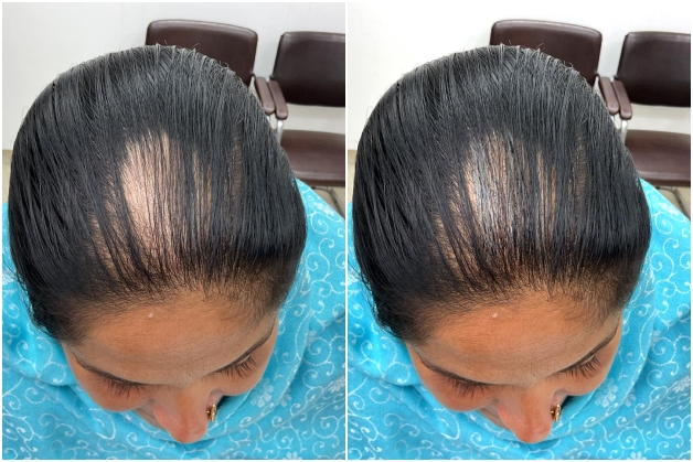 Before Treatment